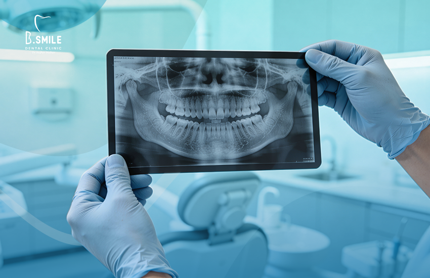 أشعة الأسنان